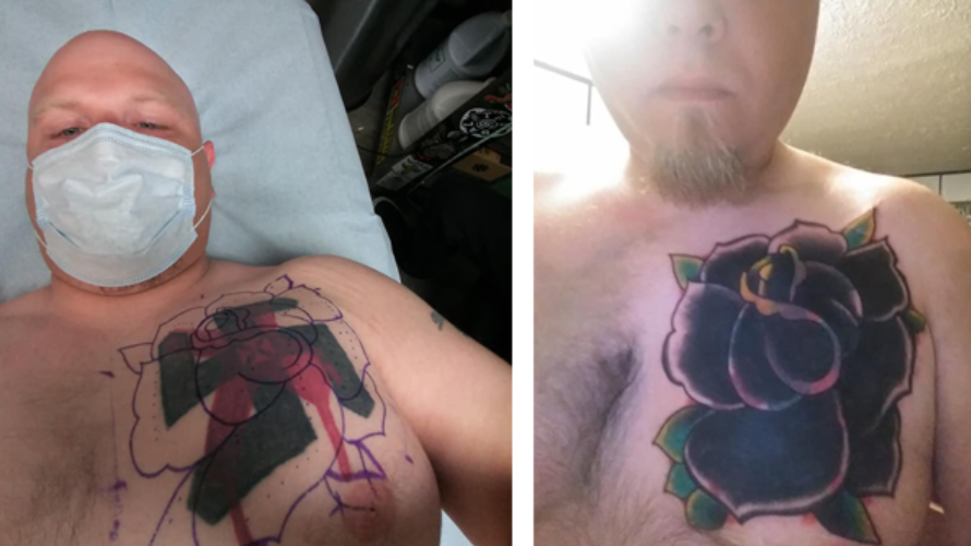 He Tattooed A Hate Symbol On His Chest Fifteen Years Later Colerain