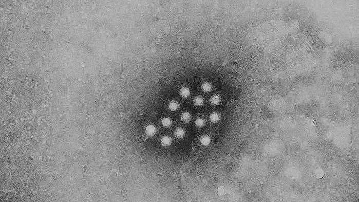 Hepatitis A outbreak reported in Mississippi, health officials say - WAPT Jackson thumbnail