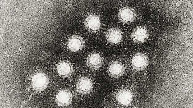 Cropped image of an electron micrograph of the Hepatitis A virus