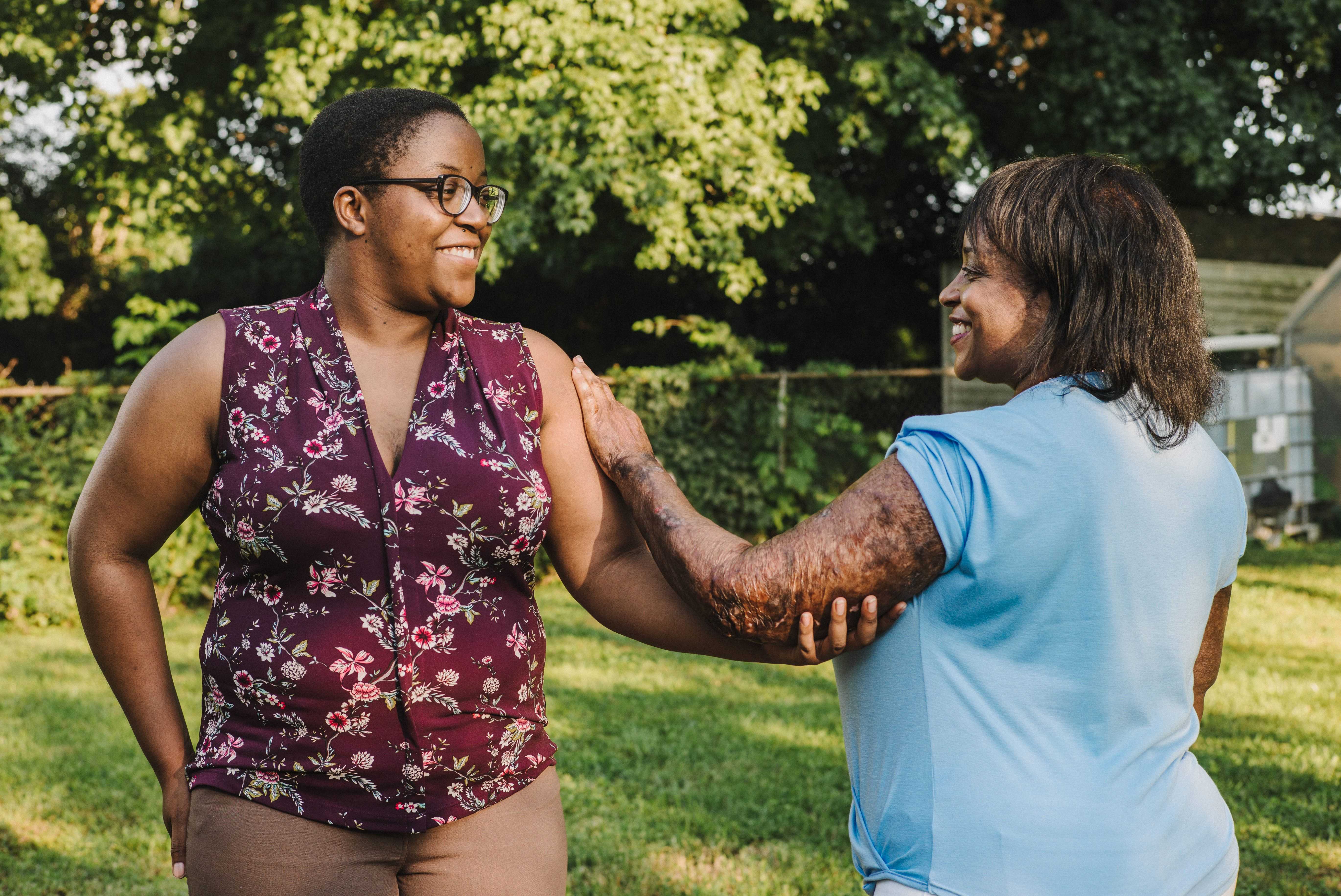 Louisville Woman Shares Story On Fire Prevention Week After Suffering From Life Changing Burns