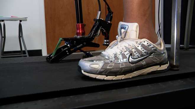 prosthetic foot