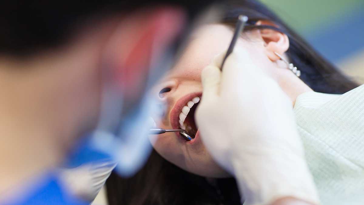 FDA warns popular dental filling could cause health problems for some patients
