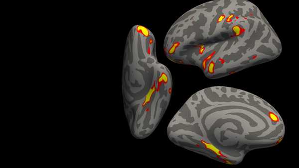 The red-yellow regions are the parts of the brain that shrink the most in the 401 SARS- CoV-2 infected participants, compared with the 384 non-infected participants. These areas are related to the sense of smell, and include the parahippocampal gyrus, the orbitofrontal cortex and the insula. We present the results in half of the brain (the left hemisphere, with inferior, side and medial views), on an average brain that has been 
