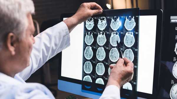 Senior neurologist with MRI scan of human head in clinic