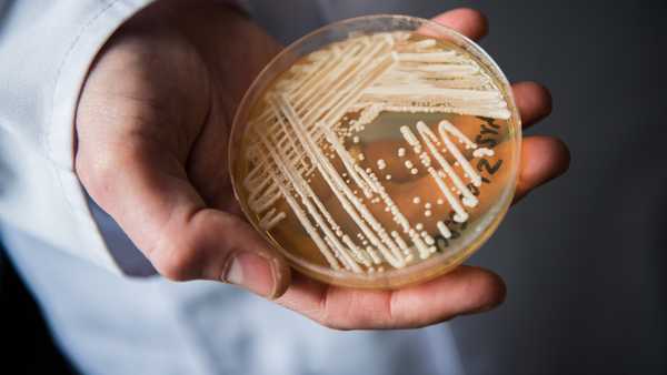 The director of the National Reference Centre for Invasive Fungus Infections, Oliver Kurzai, holding in his hands a petri dish holding the yeast candida auris in a laboratory of Wuerzburg University in Wuerzburg, Germany, 23 January 2018. There has been a recent rise of cases in Germany of seriously ill patients becoming infected with the dangerous yeast candida auris.  (Photo by Nicolas Armer/picture alliance via Getty Images)