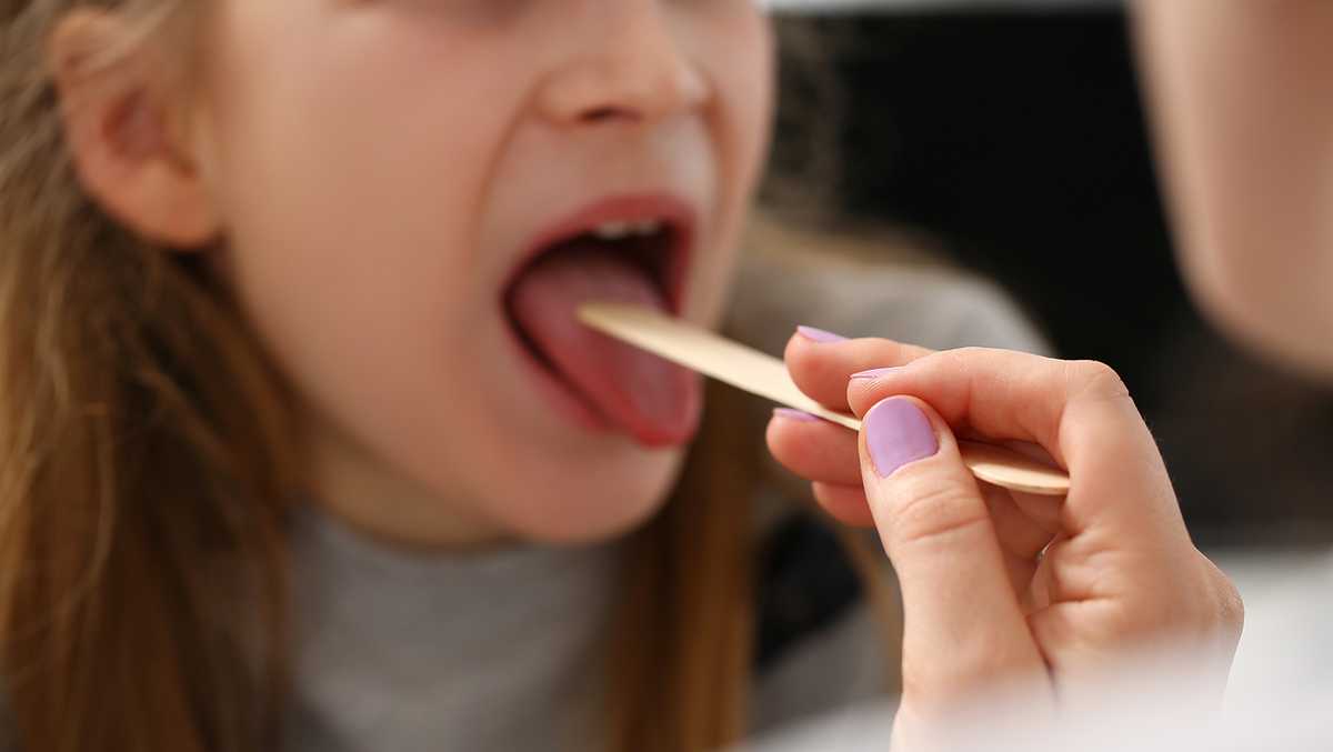 Strep infections in the US surged this winter, up nearly 30 from pre