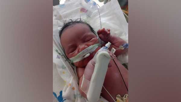 danae johnson's granddaughter, venus, was treated in the neonatal intensive care unit.