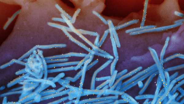 Scanning electron micrograph of human respiratory syncytial virus (RSV) virions (colorized blue) that are labeled with anti-RSV F protein/gold antibodies (colorized yellow) shedding from the surface of human lung epithelial A549 cells.