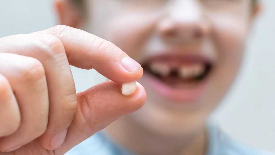3 Tips For Pulling Your Kid S Loose Tooth