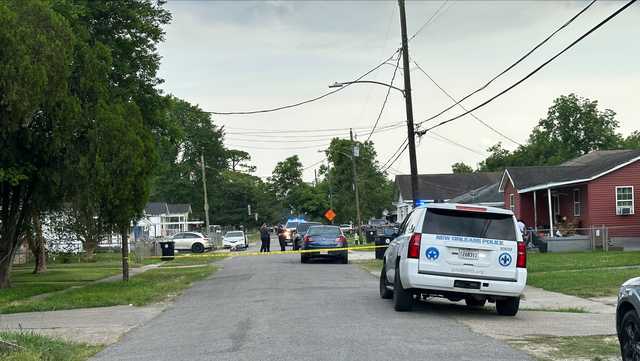 Woman shot on Casa Calvo Street, police say - Vimarsana News