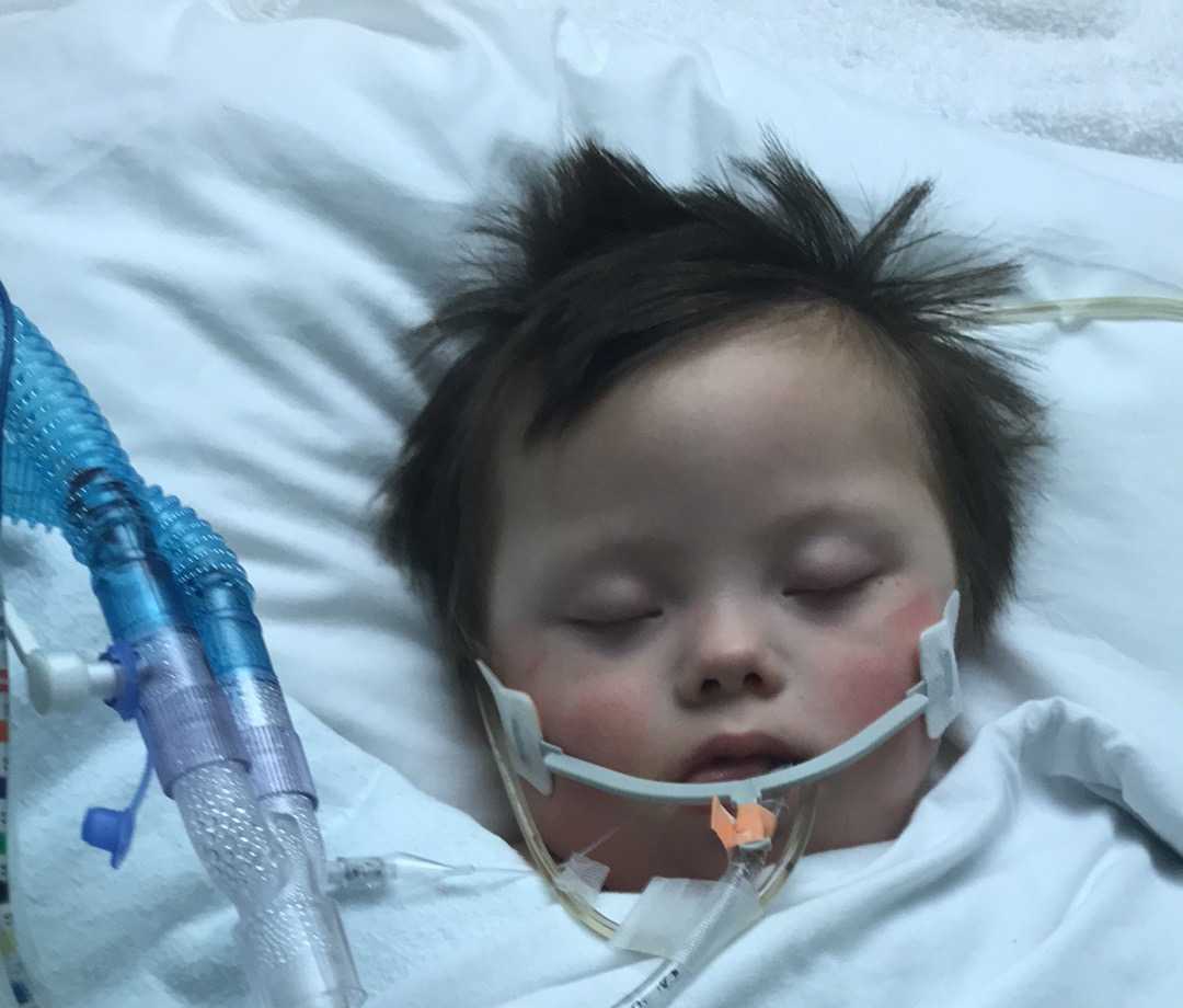 'He's our heart,' child fights for life after contracting RSV - Vimarsana News