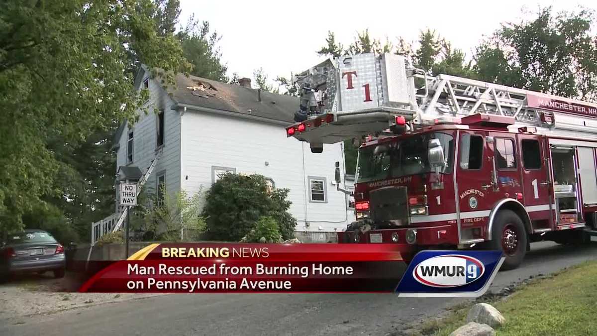 Manchester man flown to Boston with 2nd-degree burns after house fire