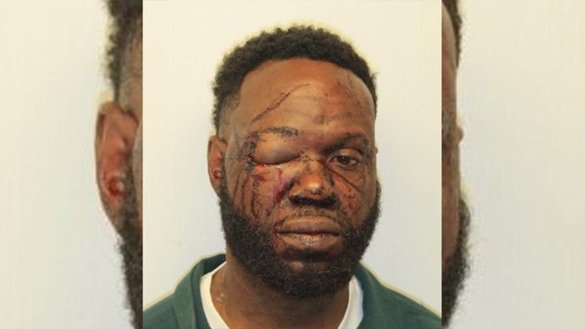 Police: Suspect quickly arrested after stabbing outside Savannah bar - Vimarsana News