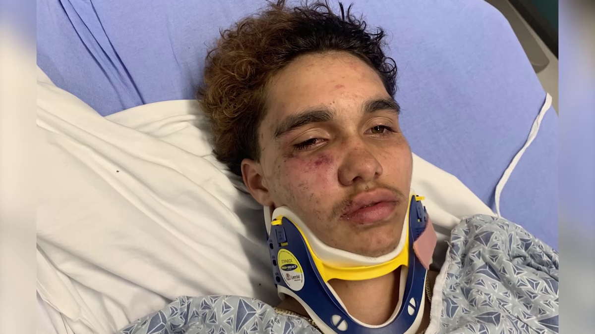 Teens Charged in Assault on Transgender Teen