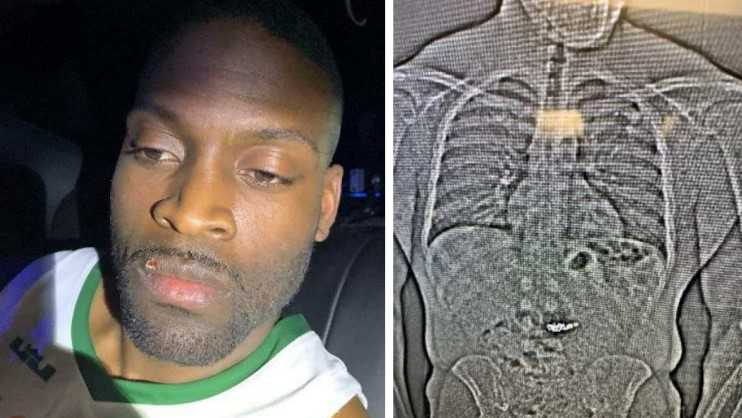 Florida man accused of swallowing nearly $1M in stolen Tiffany jewelry found gui...
