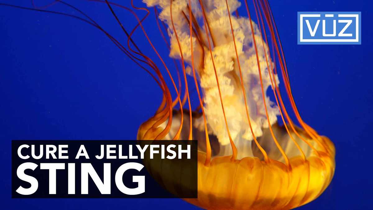 THIS is the right way to treat a jellyfish sting. Hint Don’t pee on it.