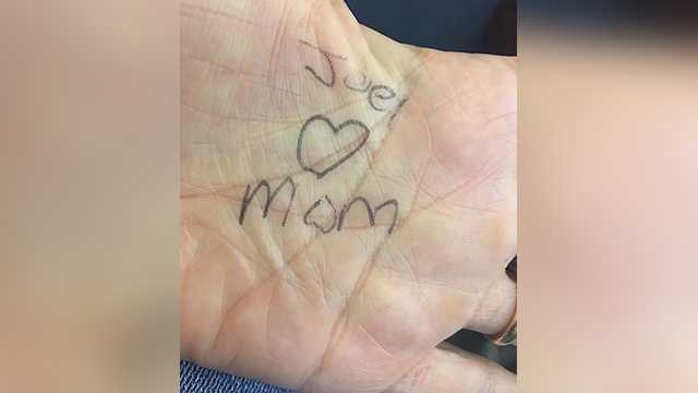 A message Stacey Gagnon's son, Joel, wrote on the palm of her hand after she helped him through a tough moment related to his disfigurement.