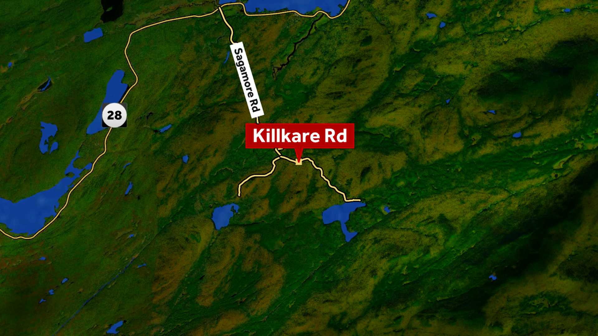 North Country home explosion: 3-year-old severely burned - Vimarsana News