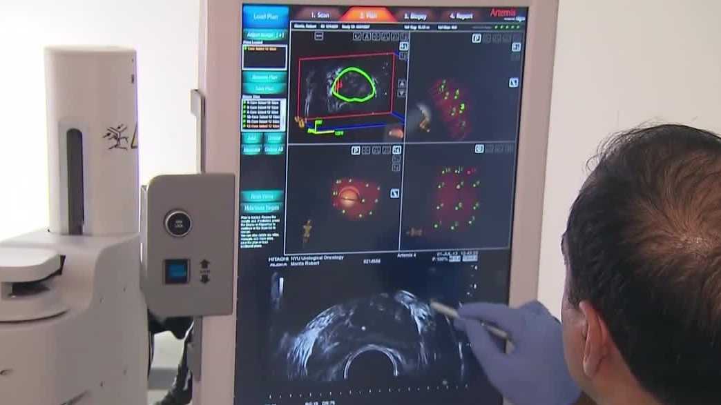 Local doctors stress colorectal cancer awareness after actor's death