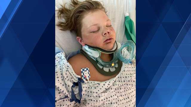 Lucas Cirivello, 13, is recovering after tree fell on top of him at a birthday party - Vimarsana News