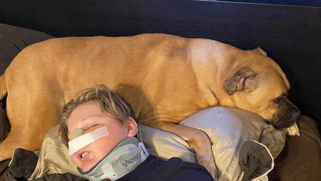 Teen injured by falling tree returns home from hospital - Vimarsana News