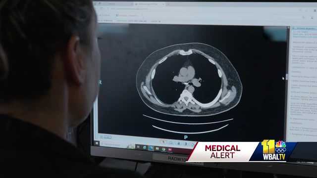 UM, AstraZeneca partner to boost lung cancer screenings