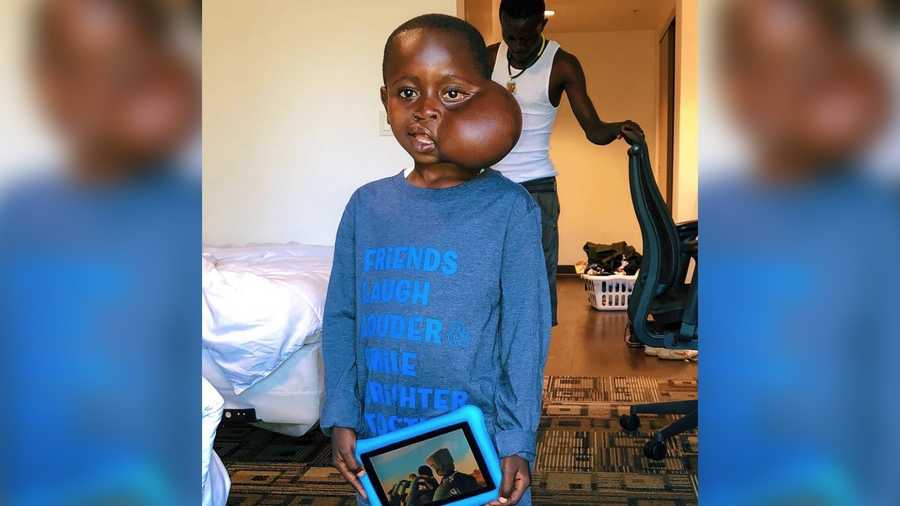 The Dikembe Mutombo Foundation says 8-year-old Matadi Sela Petit died after suffering a rare genetic reaction to anesthesia during surgery.