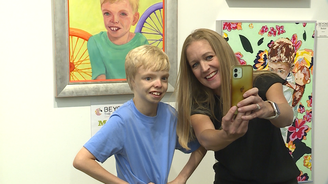 Arkansas Children's Northwest art show spotlights rare diseases - Vimarsana News
