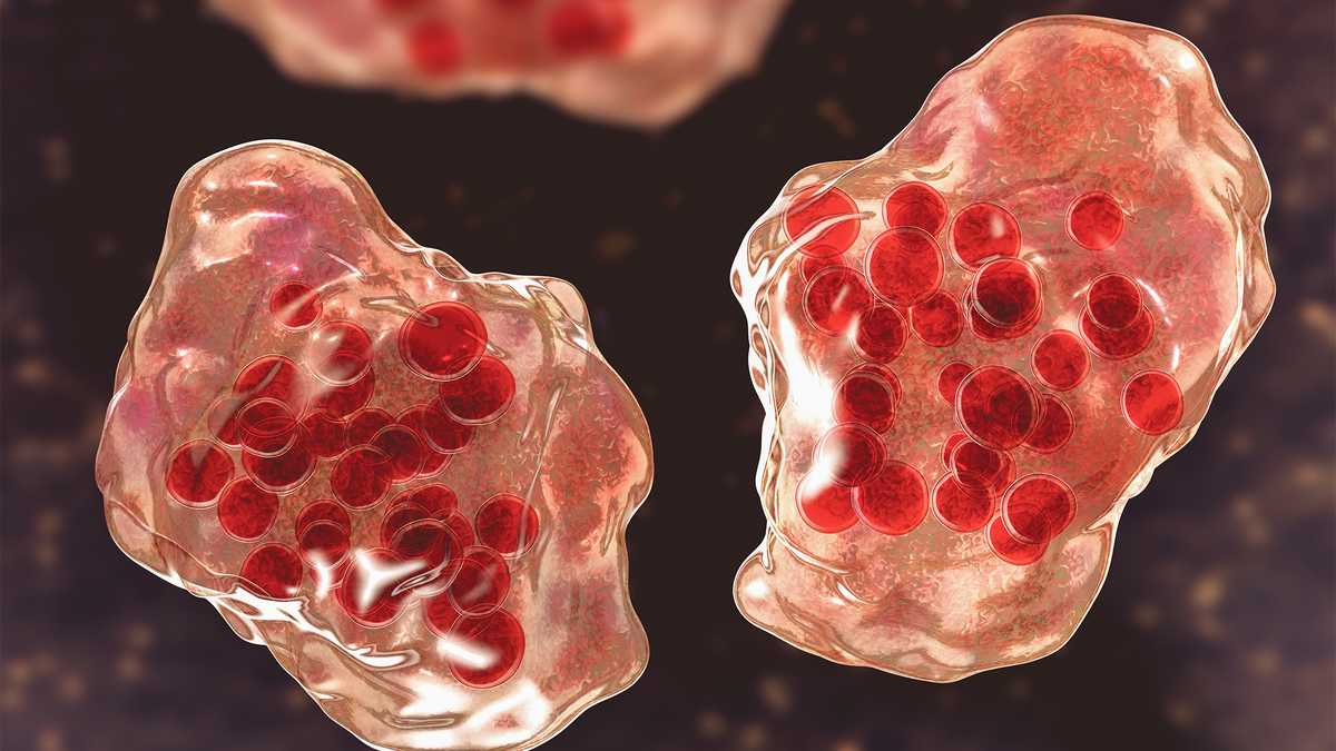 MDH: Measles cases identified in Southern Maryland