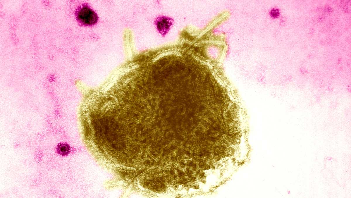 Placer County Public Health reports 3 confirmed measles cases, fourth suspected case