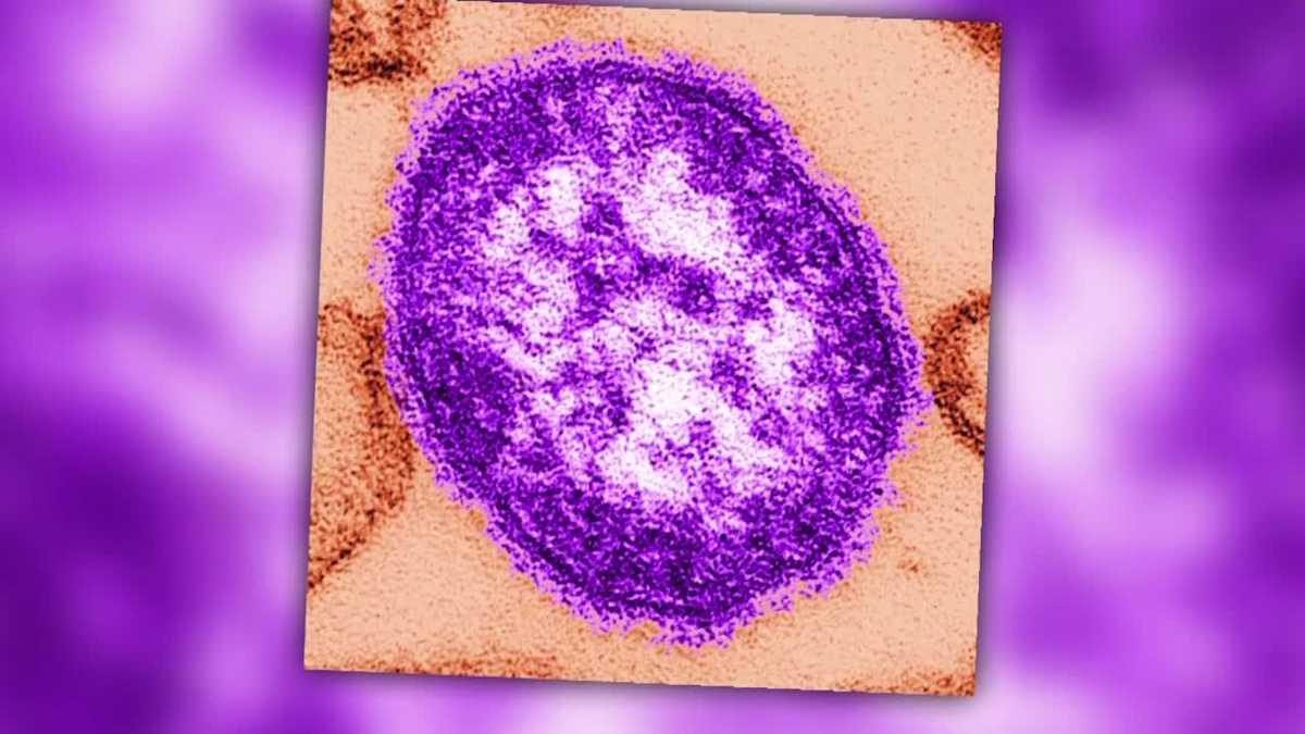 Measles case confirmed in Boston, Public Health Commission says - WCVB Boston thumbnail