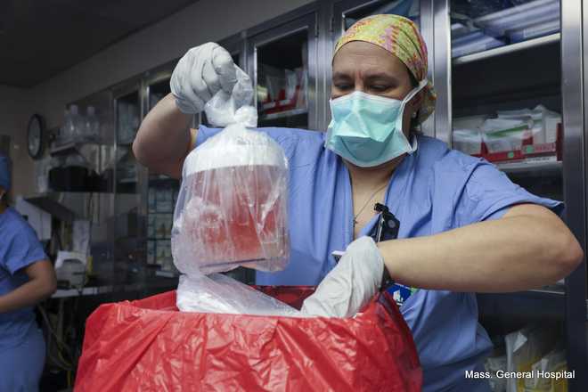 The hospital says the pig kidney with 69 genomic edits was successfully transplanted into the patient living with end-stage kidney disease. The hospital says the pig kidney with 69 genomic edits was successfully transplanted into the patient living with end-stage kidney disease.