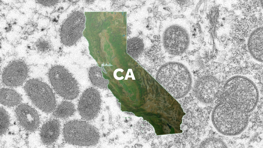 Monkeypox in California
