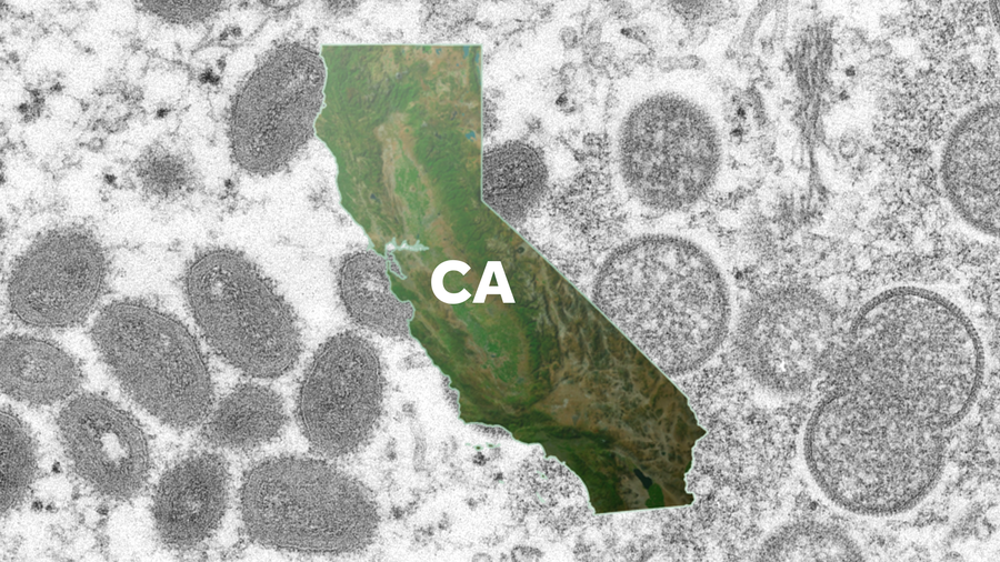 California monkeypox cases fall, but health disparities remain California monkeypox cases fall, but health disparities remain