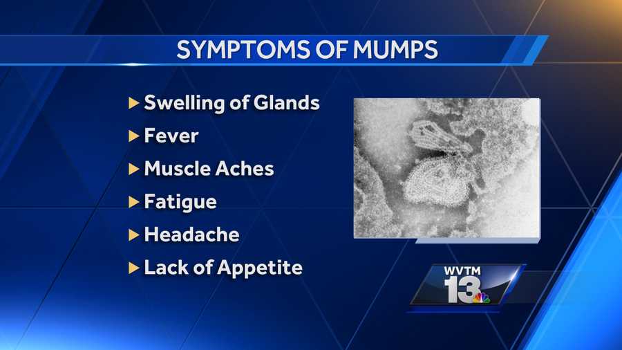Mumps Symptoms
