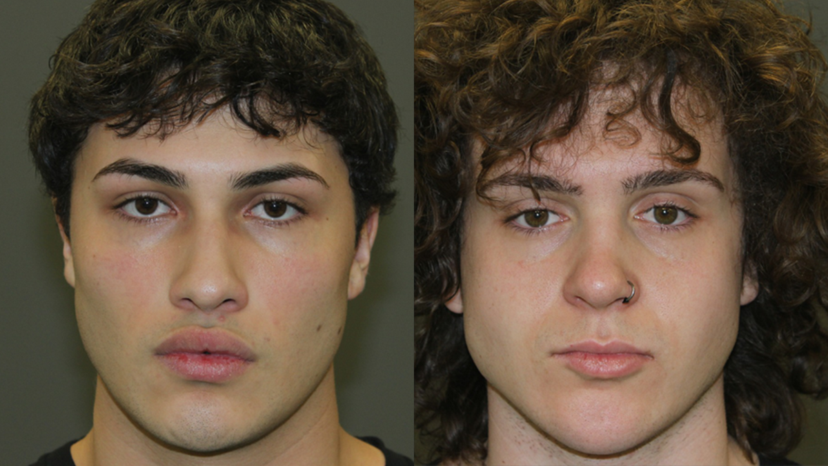 Two Men Charged with Rabbit Death in Massachusetts