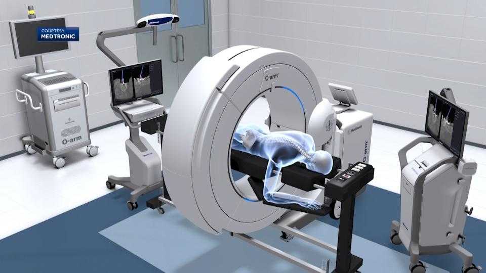 New Oarm technology helps surgeons get clearer picture