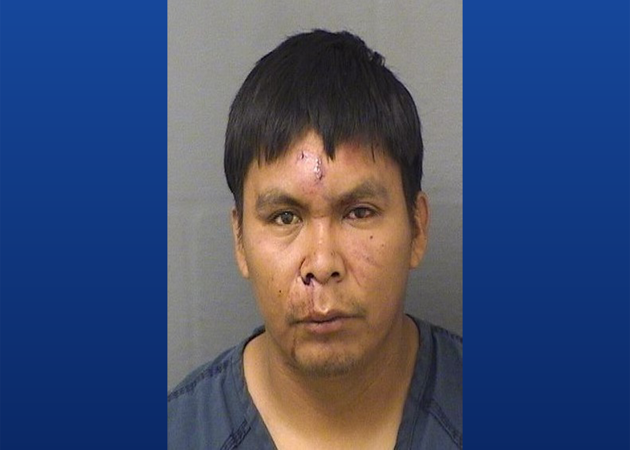 Guatemalan man pleads guilty to aggravated battery in Palm Beach County