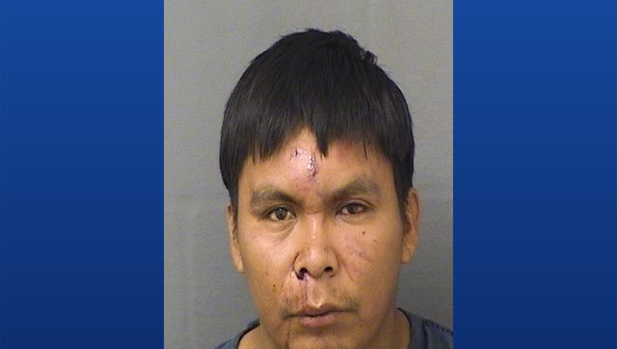 Guatemalan man pleads guilty to aggravated battery in Palm Beach County