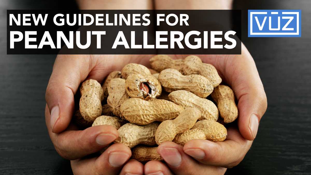 new-guidelines-for-peanut-allergies