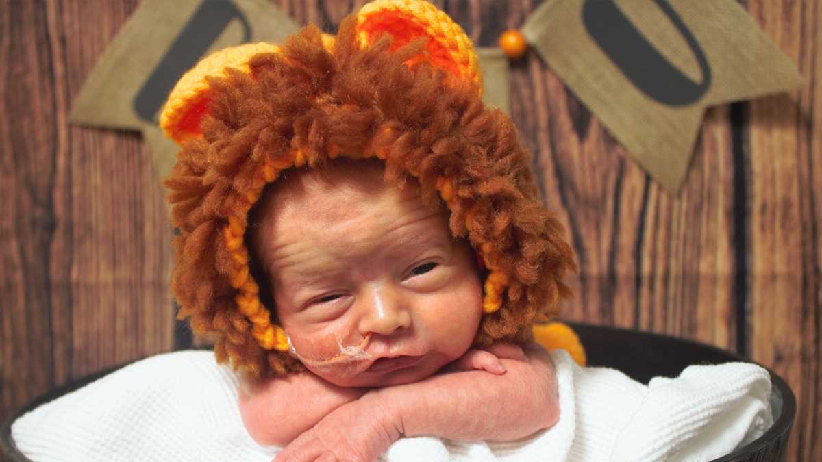 IMAGES, U of L NICU babies dress up for Halloween!, News