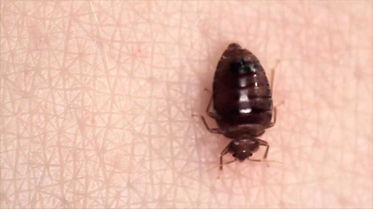 Baltimore ranked top bed bug city in US