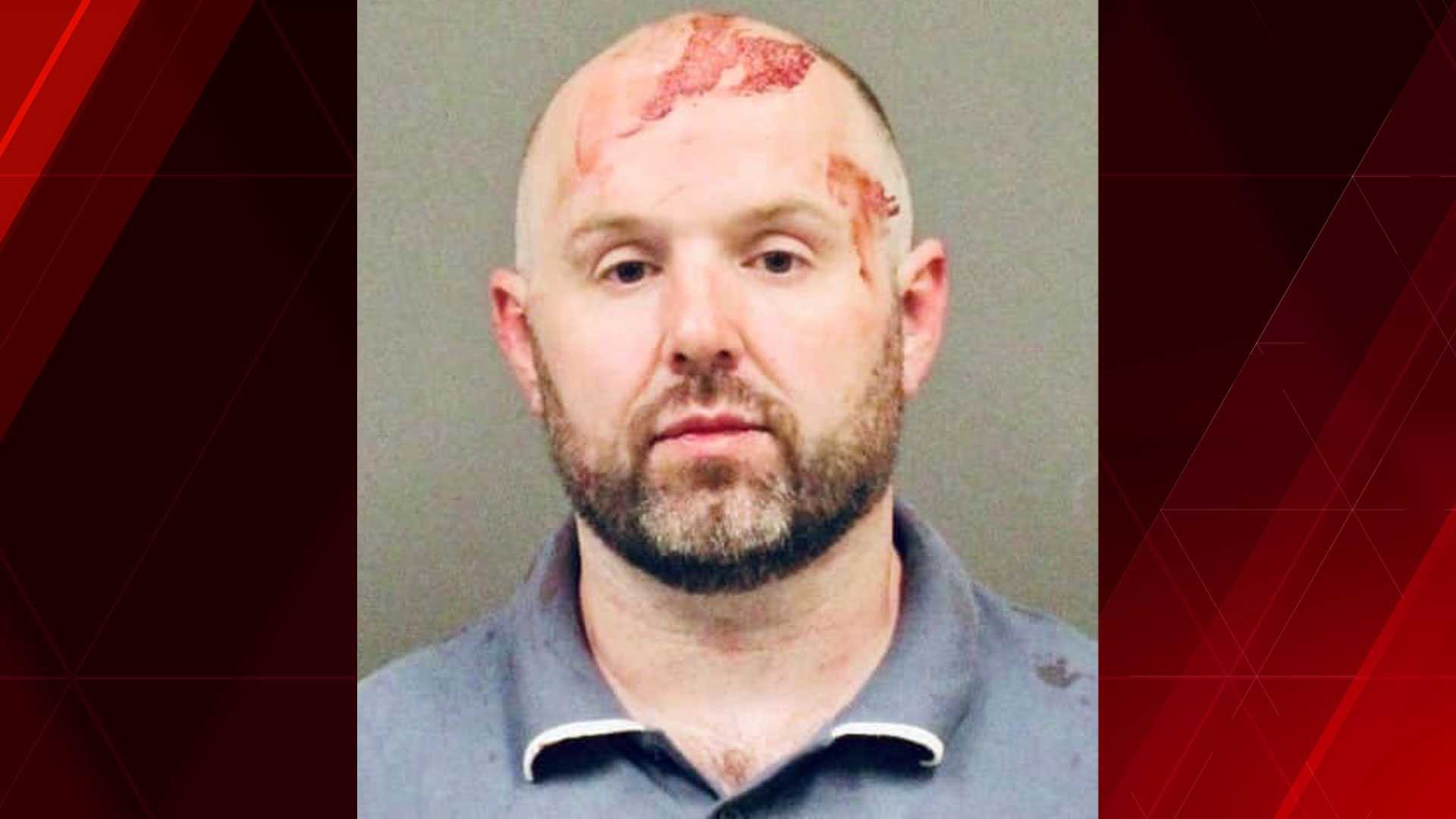 Mass. man bites chunk out of another man's ear during fight, police say - Vimarsana News