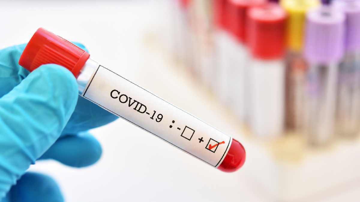 positive coronavirus sample