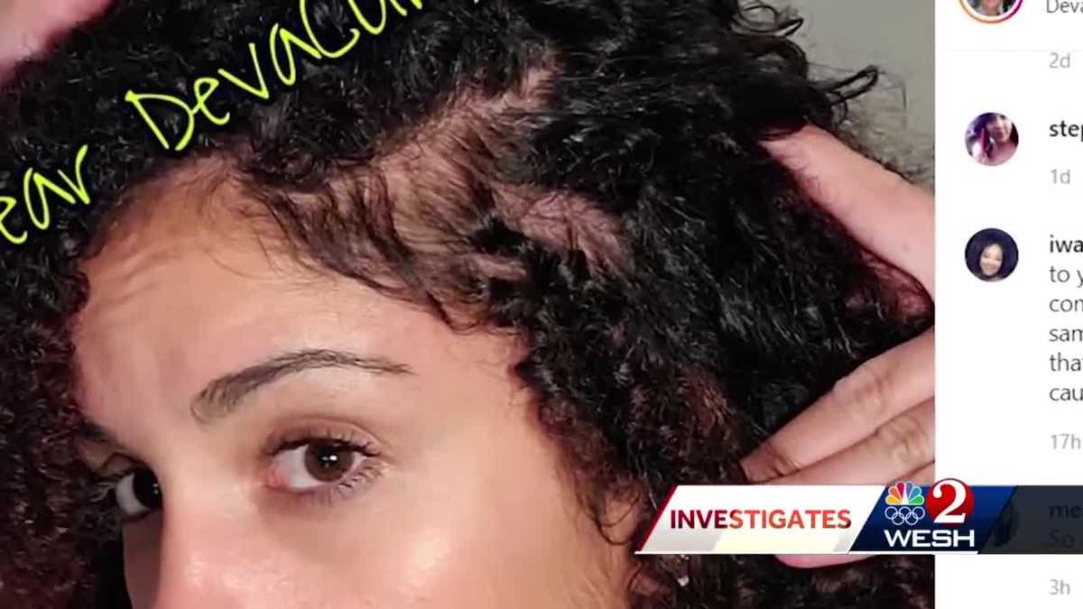 DevaCurl lawsuit Consumers claim products cause hair loss