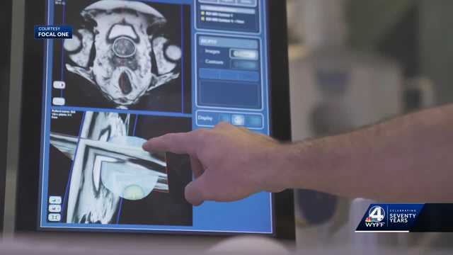 South Carolina: New, less invasive treatment for prostate cancer - Vimarsana News