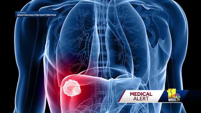 Researchers at Hopkins work to make blood test to detect cancer - Vimarsana News
