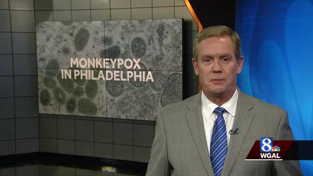 First case of monkeypox confirmed in Philadelphia - Vimarsana News