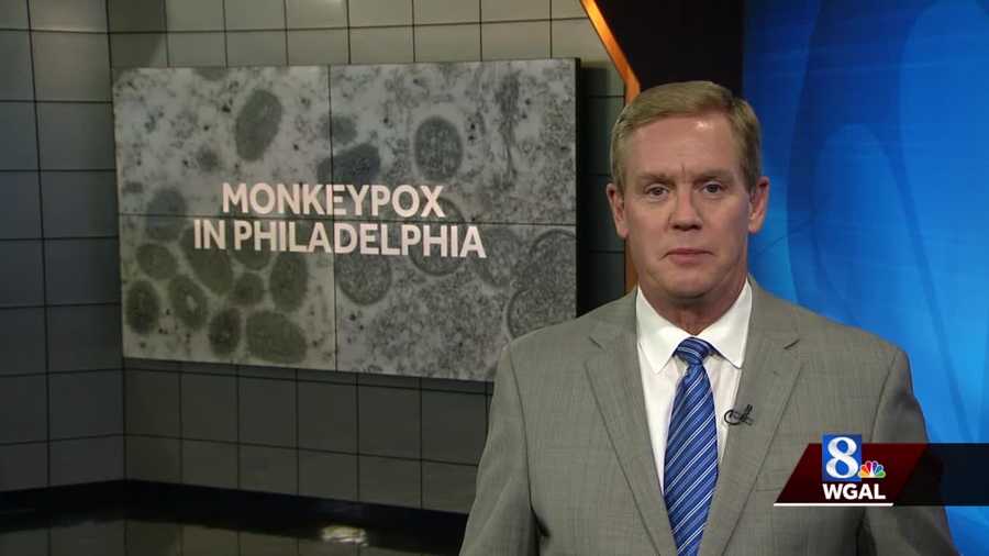 monkeypox case confirmed in philadelphia