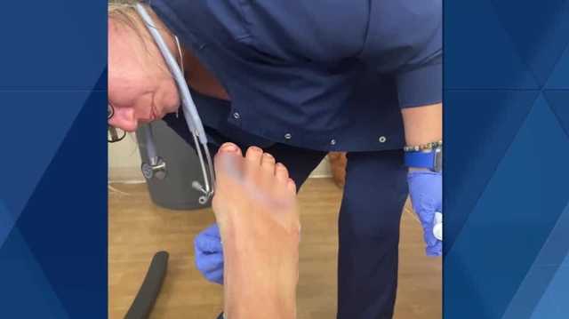 Surfer shares moment he was bit by shark in Fort Pierce - Vimarsana News